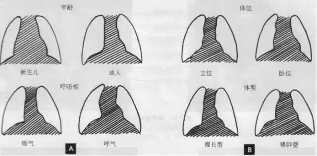 休闲小白鞋夏,献血小板相当于献血多少