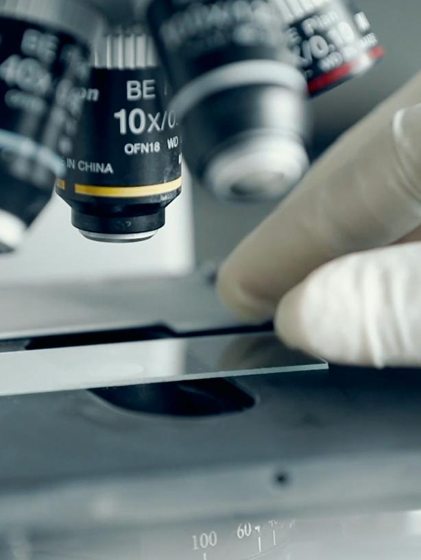 炎症变癌症,肺部有炎症会不会转化癌症