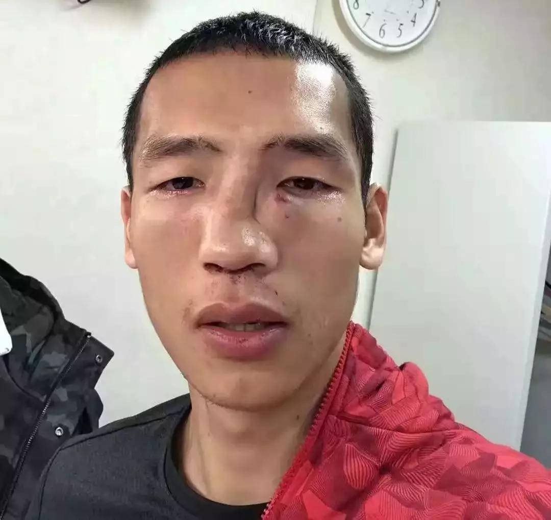 中国拳击vs日本拳击真实差距,中国拳击与日本拳击