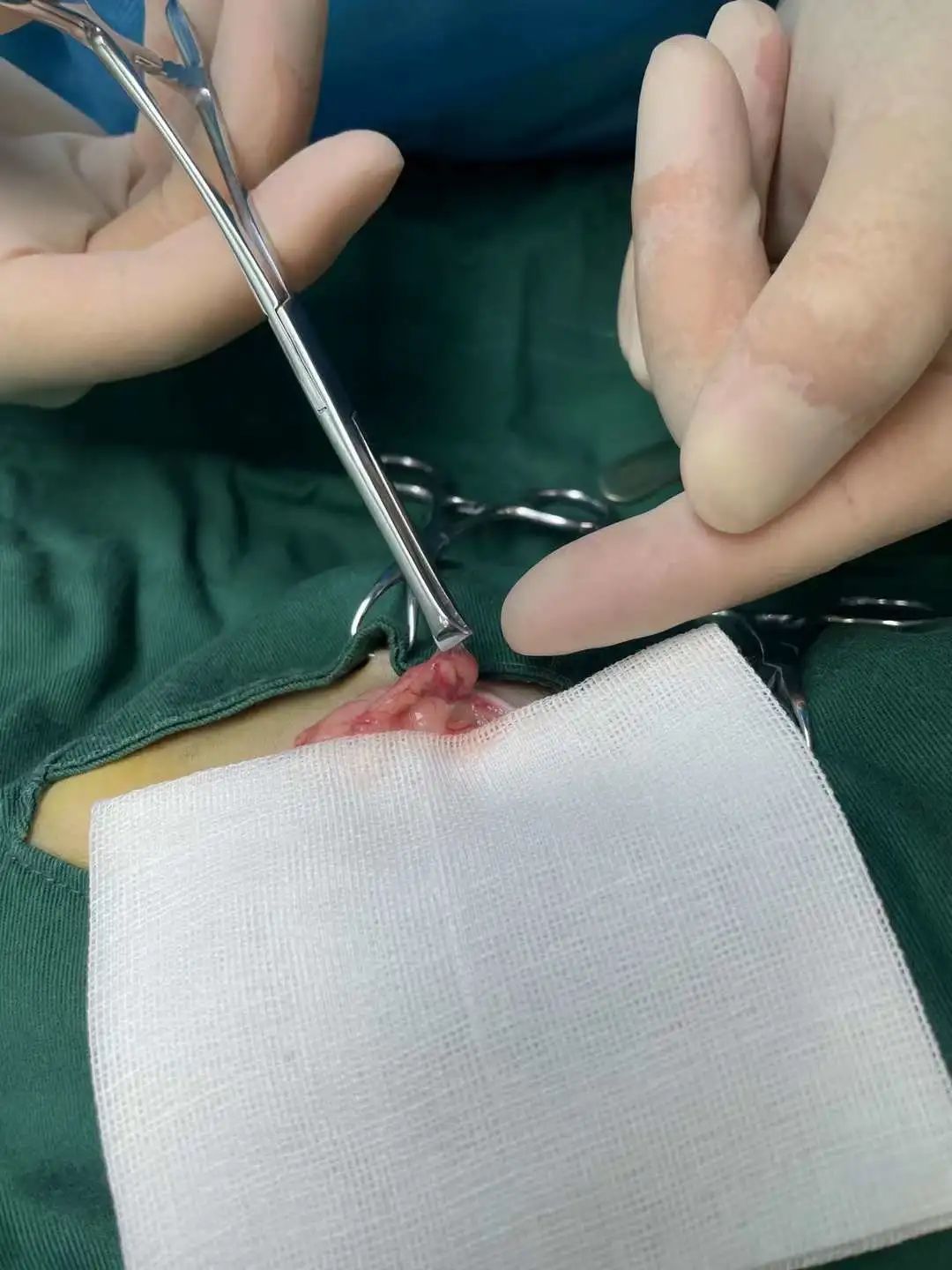 猫咪到底为什么绝育后还会发情呢?