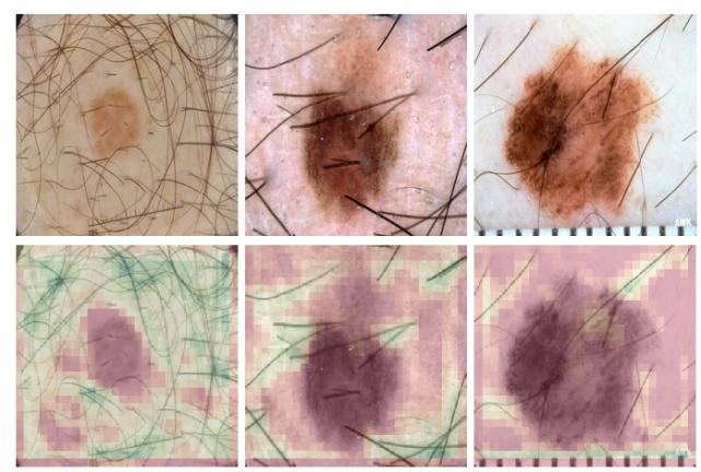 浅谈医学影像学习与实践,基于深度学习的医学影像研究思路