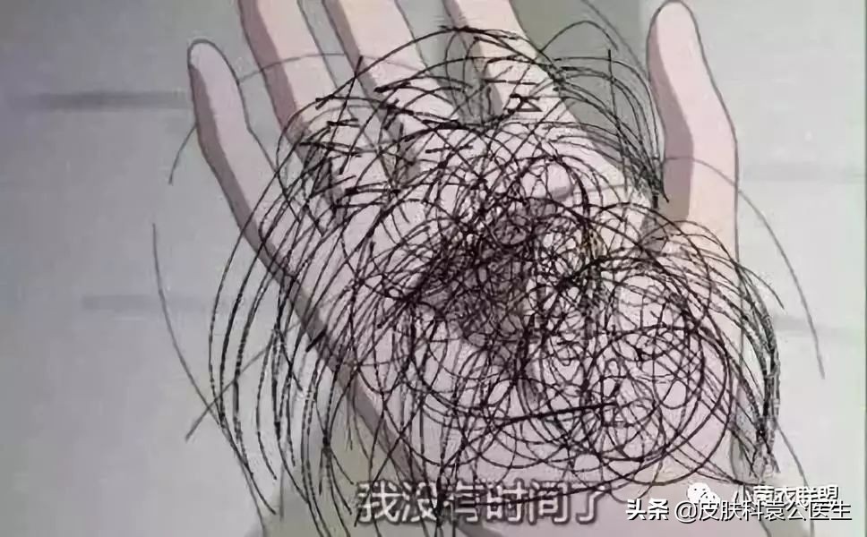 脱发严重但是头发还是很浓密,脱发头发油腻怎么办