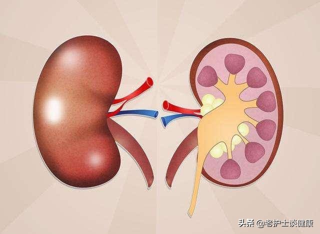 糖尿病需不需要及时干预治疗,糖尿病肾衰竭的症状和治疗方法
