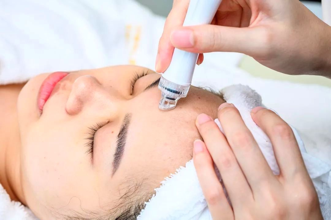 还在为粉刺黑头烦恼吗,还在为黑头而烦恼吗