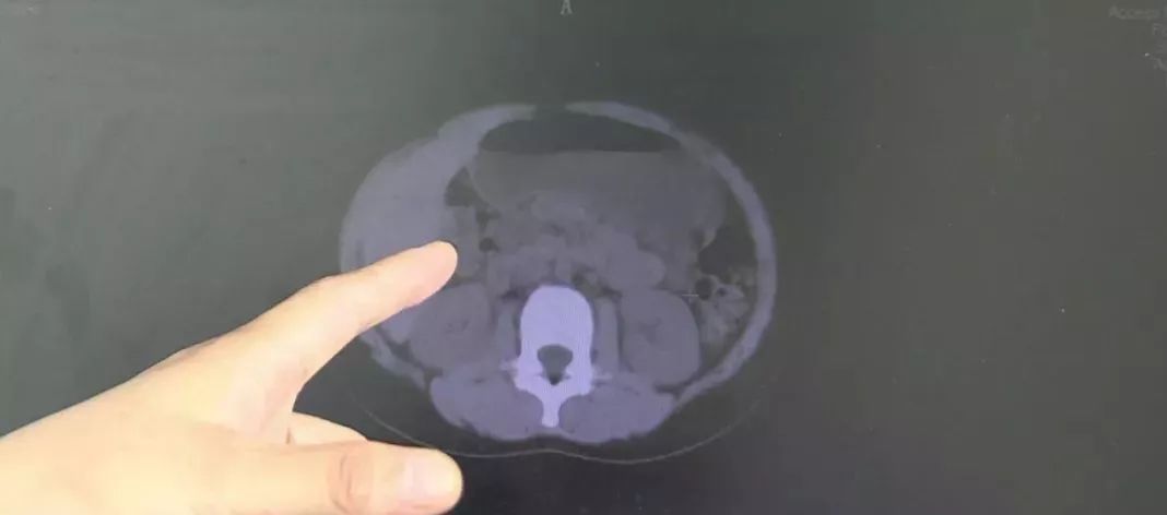 8岁小女孩便秘是什么原因,8岁女孩便秘是什么原因造成的