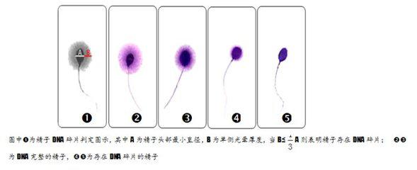 女性出现胎停怎么回事,经常胎停流产怎么解决