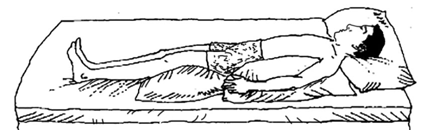 脑卒中健康科普知识课件,防卒中科普