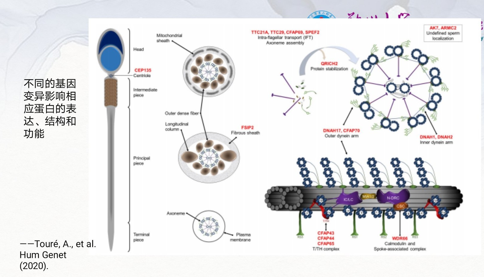 严重弱精症原因,重度少精弱精症可能的原因
