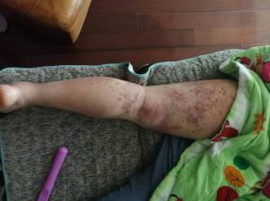 拍打膀胱有什么好处,拍打膀胱有助排尿吗