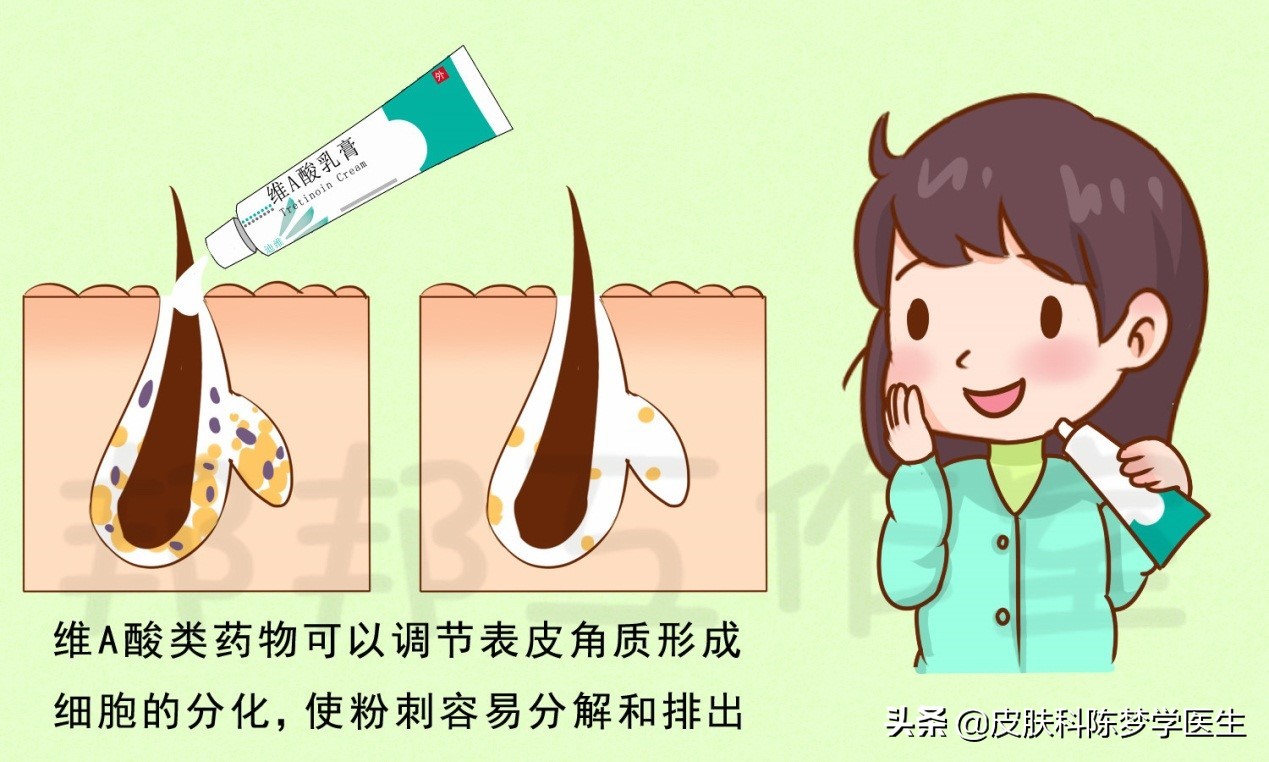 青春痘怎么快速消除不用药物,脸上起青春痘用什么中草药偏方好