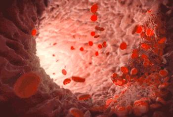 洗血净化,什么叫洗血疗法