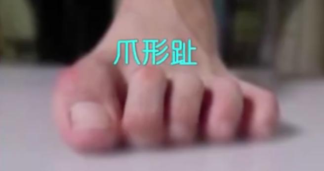 怎么选择适合自己脚型的鞋,怎样选一款适合自己脚型的鞋