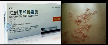 抗肿瘤药,直接影响DNA结构和功能的药物