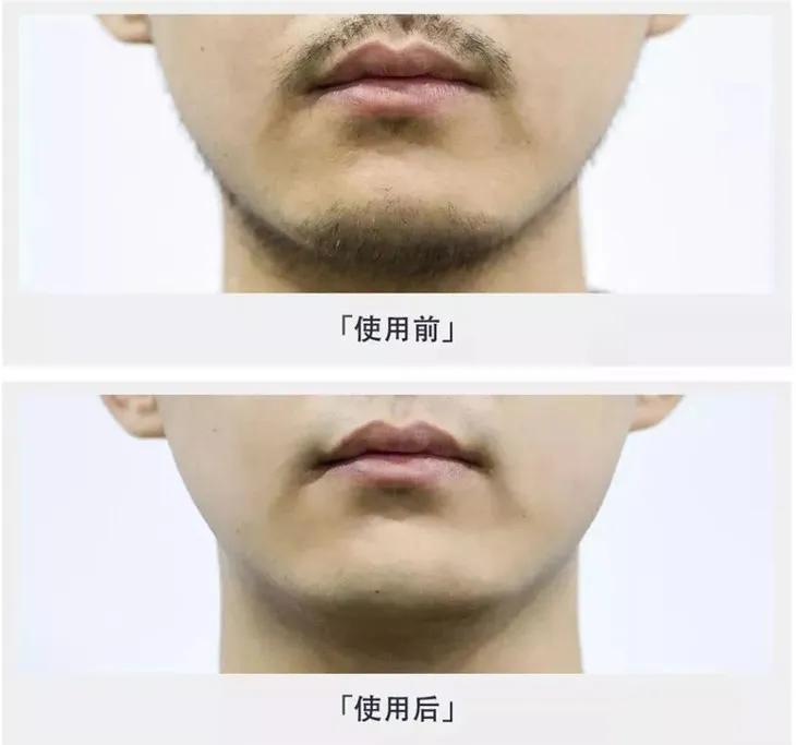 得过设计奖的便携式剃须刀 (红点奖剃须刀视频)