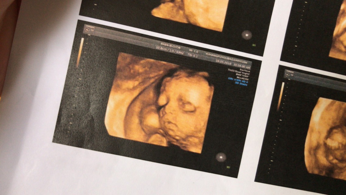 七夕一生有你彼此珍惜,七夕缘分来之不易