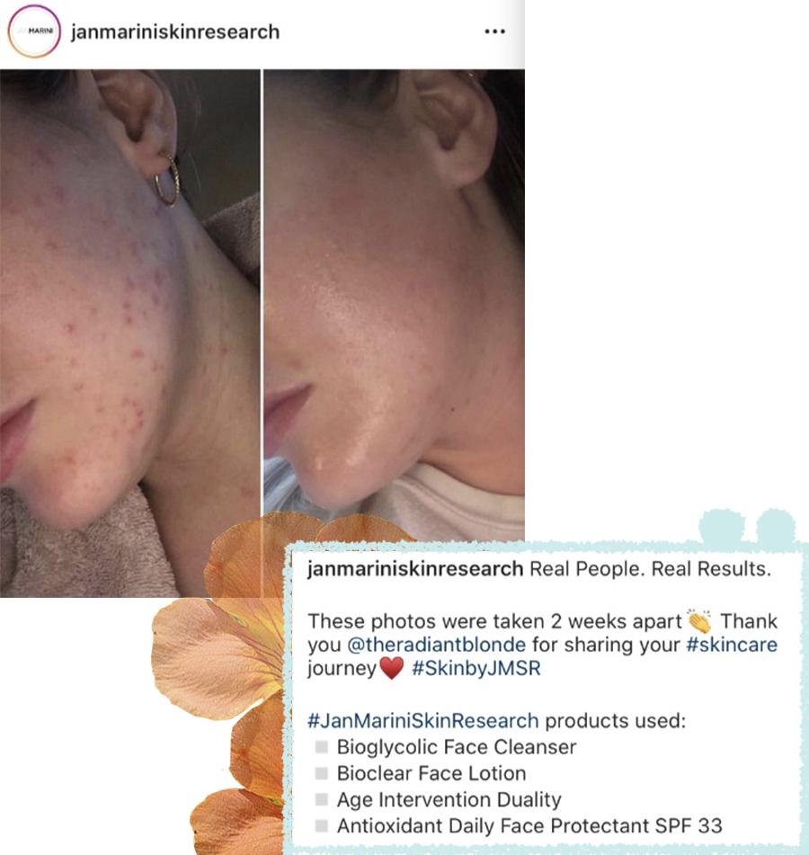 敏感肌痘痘肌大干皮统统看过来,敏感痘痘肌可以用什么产品