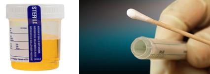 女士尿痛可能会是怎么回事？不一定都是感染