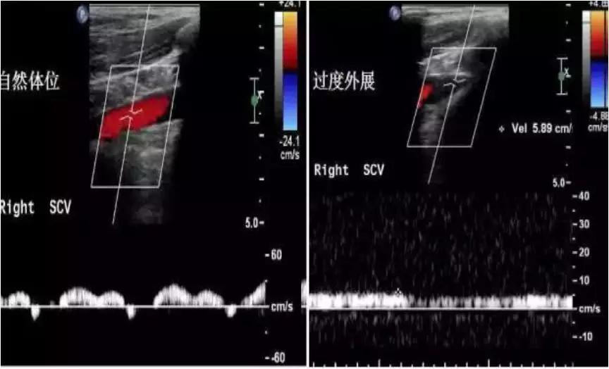 肩臂痛怎么治疗,肩臂痛什么原因
