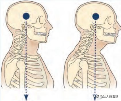 改善头前伸肩膀内扣,一招改善头前伸