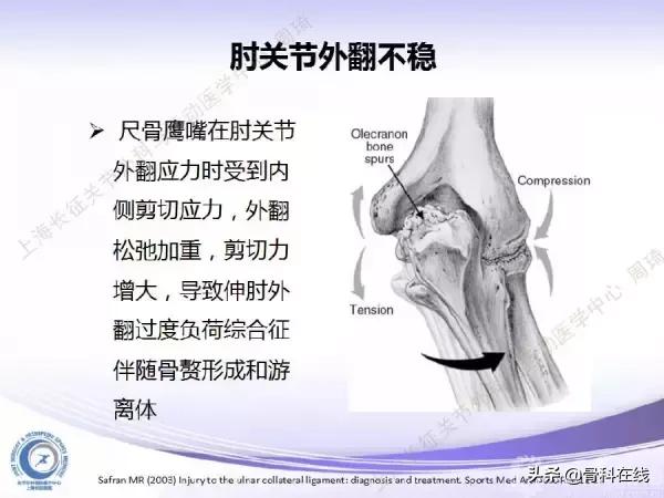 肘关节镜手术后引流,肘关节镜微创手术
