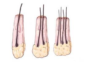防脱发最好的食疗方法,防脱发治秃头
