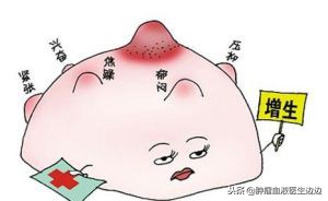 肿瘤医生最常问的问题,癌症重要的早期预警信号