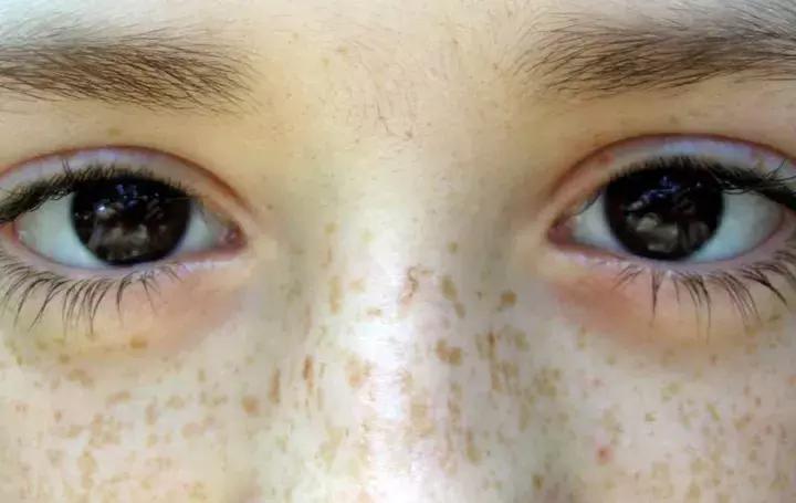 面对百「斑」刁难，你该如何反击......