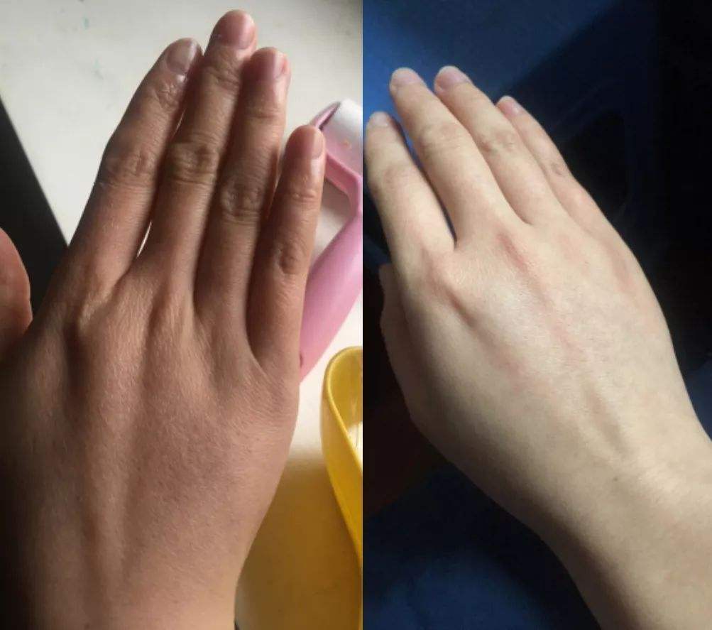 王凯手被投保3600万？林更新堵车时不忘涂手霜，我承认自己不精致