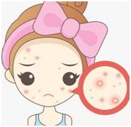 痘痘小问题,痘痘问题肌肤