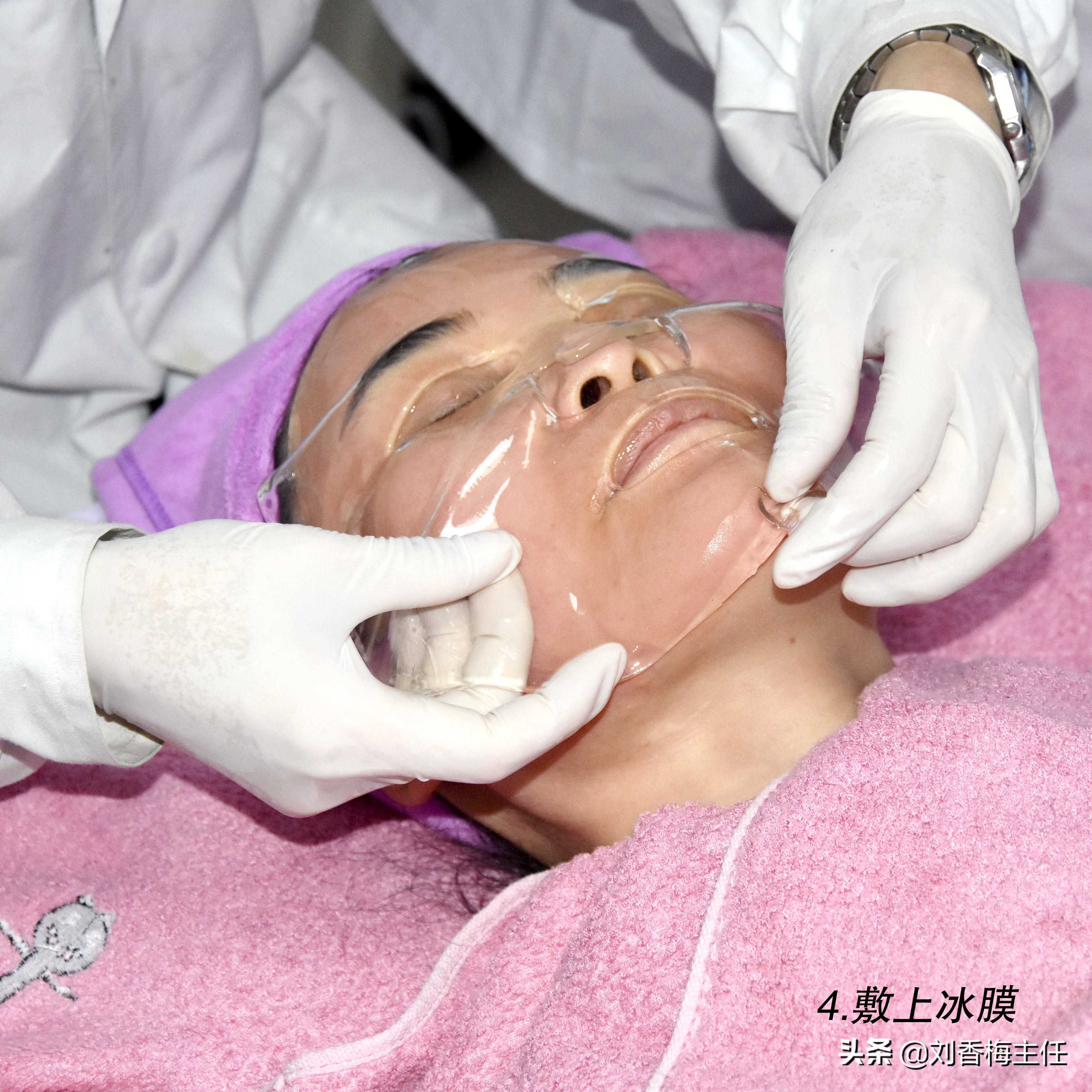 微针全解科普,微针到底有什么效果