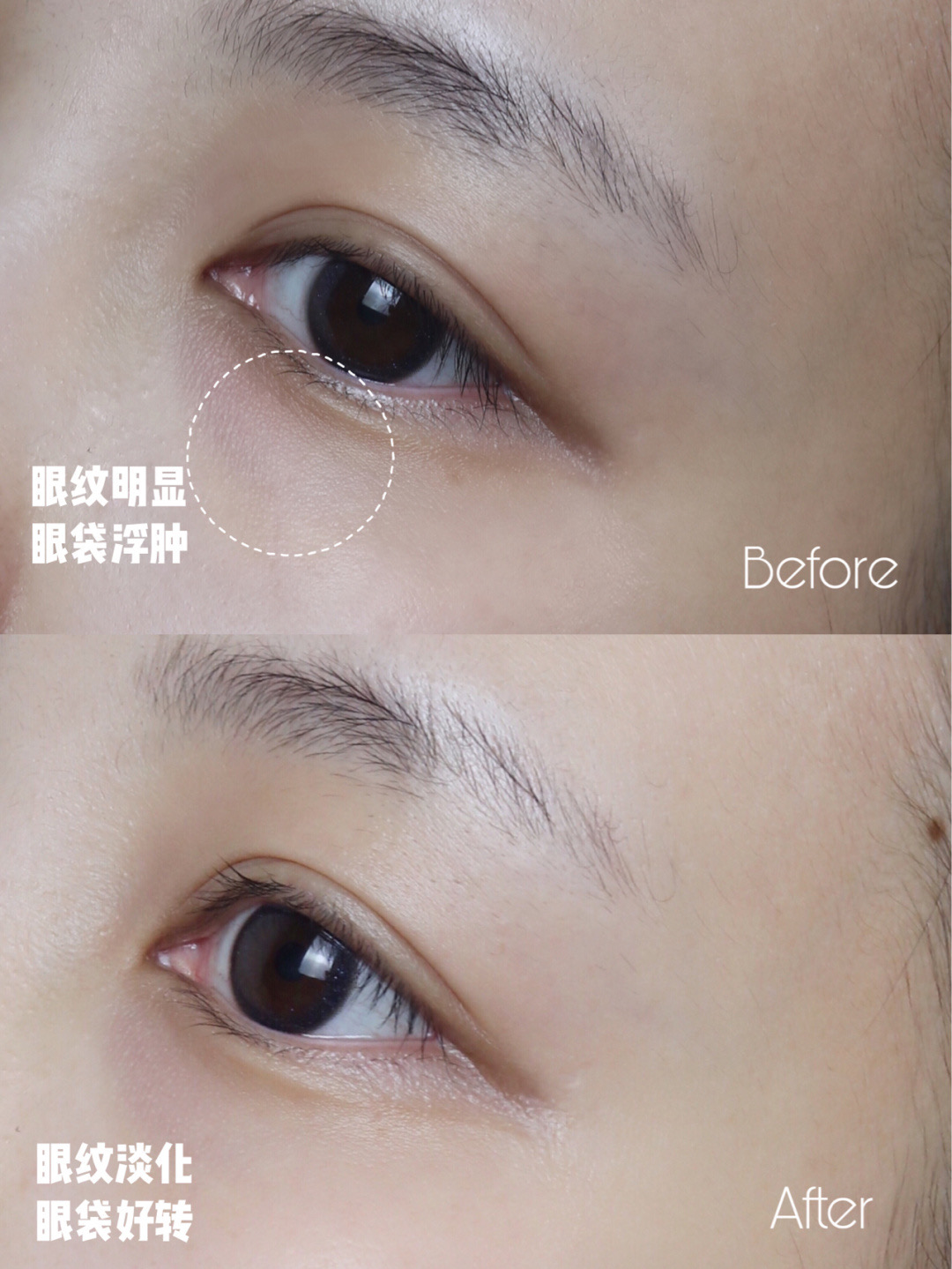 国际大牌排行前三的眼霜,cemoy眼霜雷品