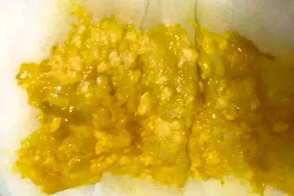 新手爸妈稳住！手把手教你看懂千姿百态大便便（超全观察指南）