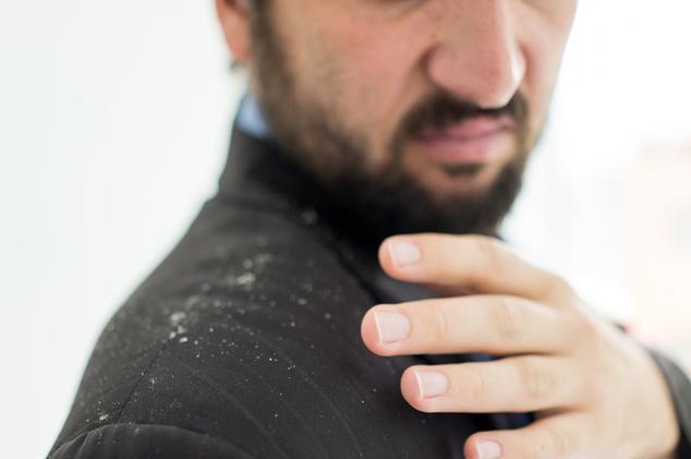 儿童有头皮屑是缺少维生素吗,头皮屑多缺维生素b2和b6