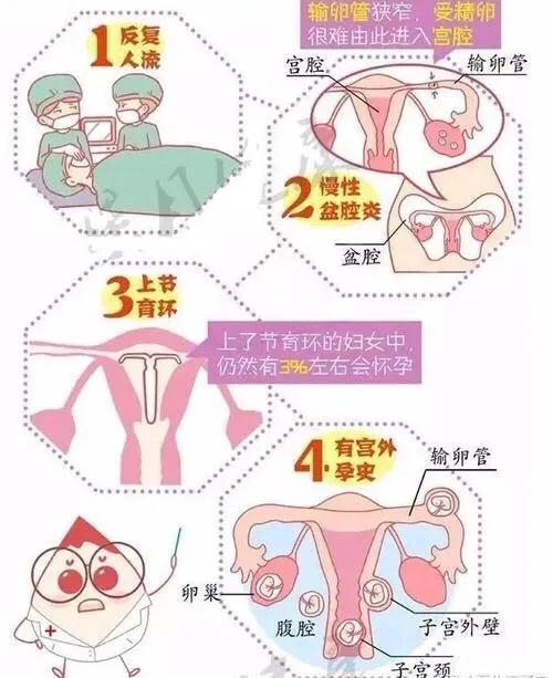 宫外孕早期保守治疗好还是手术好,怀孕初期预防宫外孕的运动锻炼