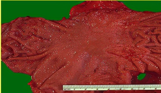 我不是药神,我不是财迷!若患胃癌,这些靶向药你有能力负担吗?