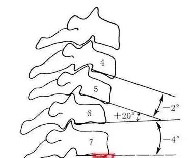 古天乐颈椎移位多少钱,古天乐颈椎移位需要多久