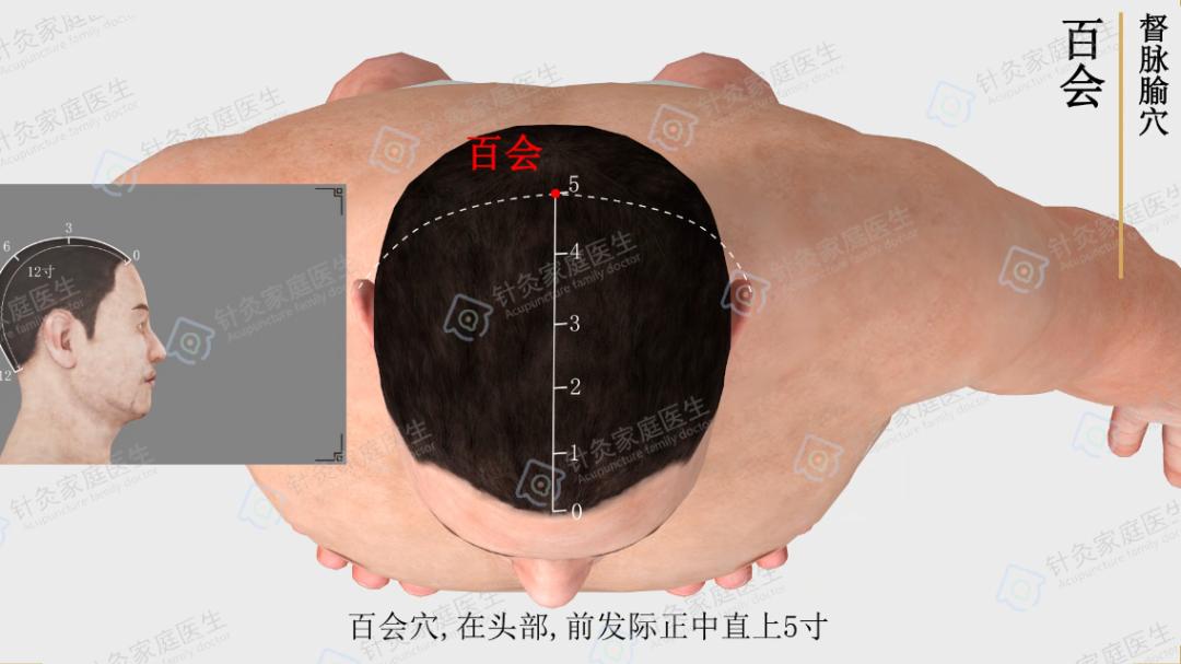 中医针灸常用的急救法，你知道吗？