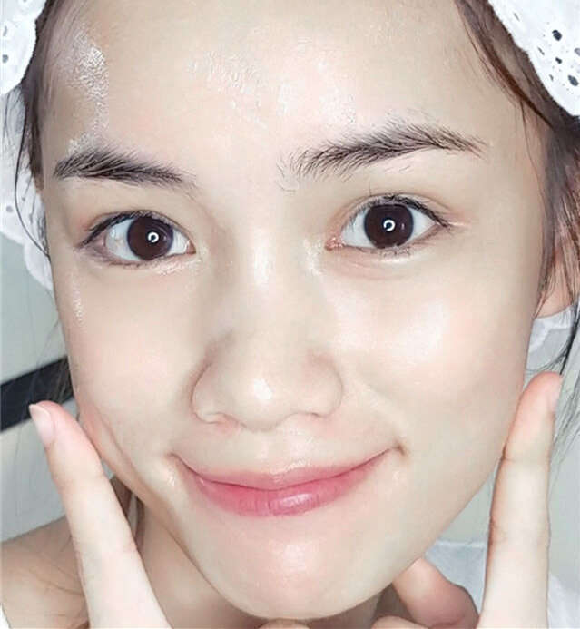 面部毛孔粗大如何改善,面部毛孔粗大怎么办如何改善