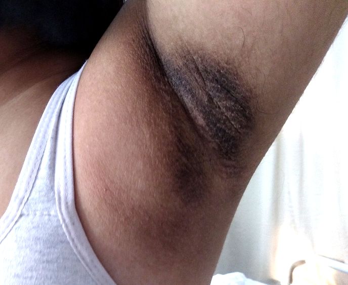 萝莉少女大长腿,为何腿毛长又黑?