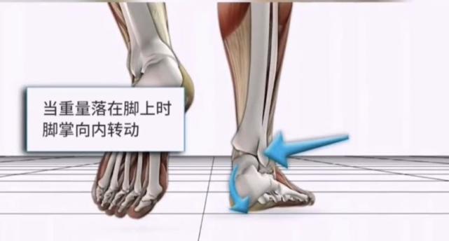 孩子走路“内八”or“外八”，可能和这3个小习惯有关