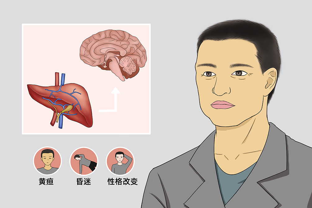 尿素循环障碍可疑什么症状,尿素循环障碍怎么确诊