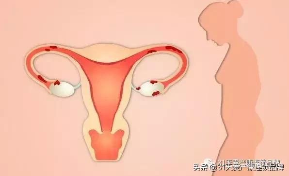 子宫最害怕什么,子宫最害怕的10件事你在做吗