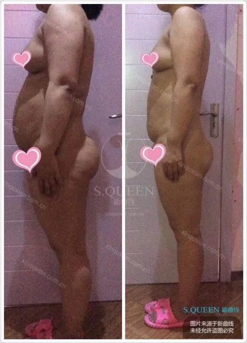 生育损害,生育后做哪些产后修复