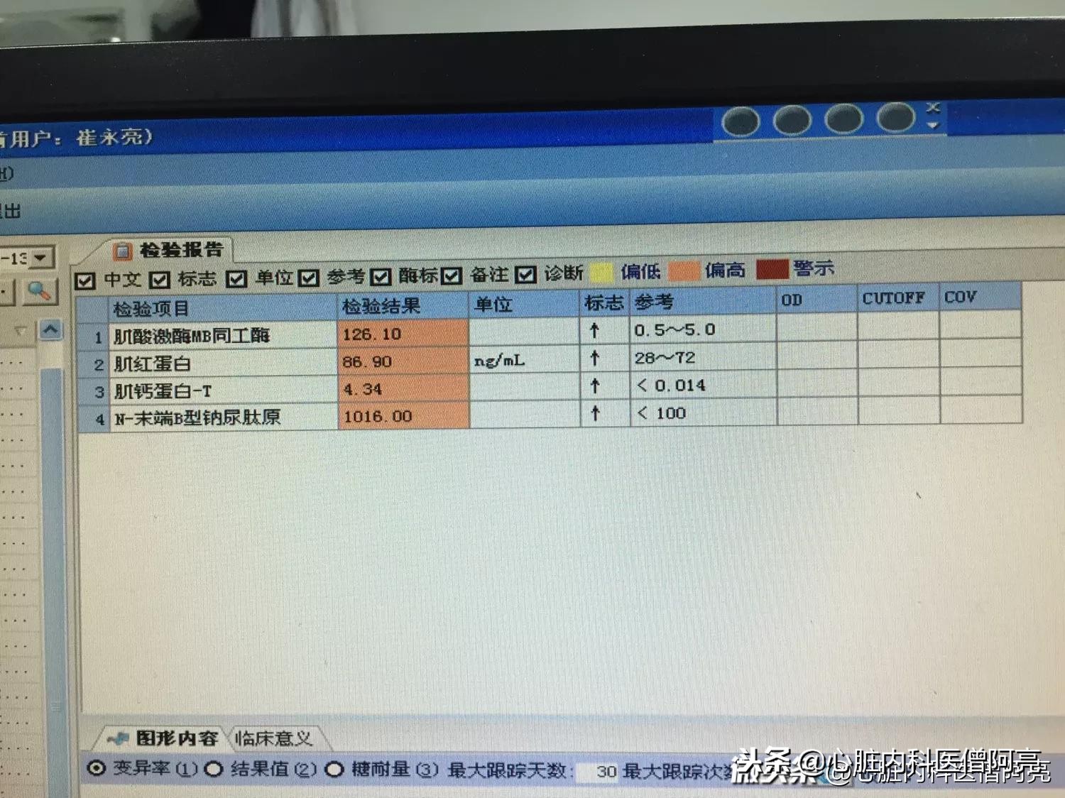 心肌炎会出现胸闷胸痛的症状吗,右侧胸闷胸痛是心肌炎吗
