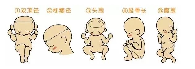 孕期复查胎儿侧脑室宽做什么b超,孕期一般做几个b超