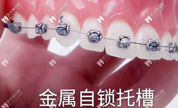 乌鲁木齐美奥口腔医院靠谱么,乌鲁木齐天山区美奥口腔