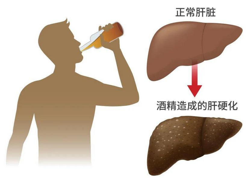 白酒最怕的解药是什么,白酒最怕的5种药