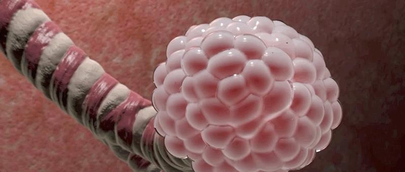 哮喘的发病原理,哮喘科普文章作品简介