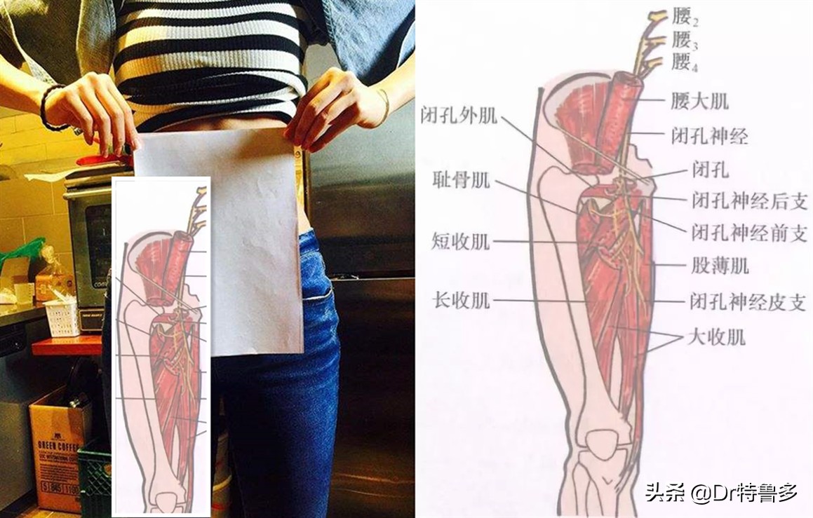 大腿内侧痛,胯也痛...有根神经被卡住了