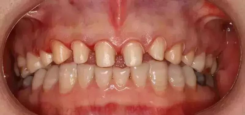 莆田系牙科坑人吗,莆田系口腔诊所曝光新闻